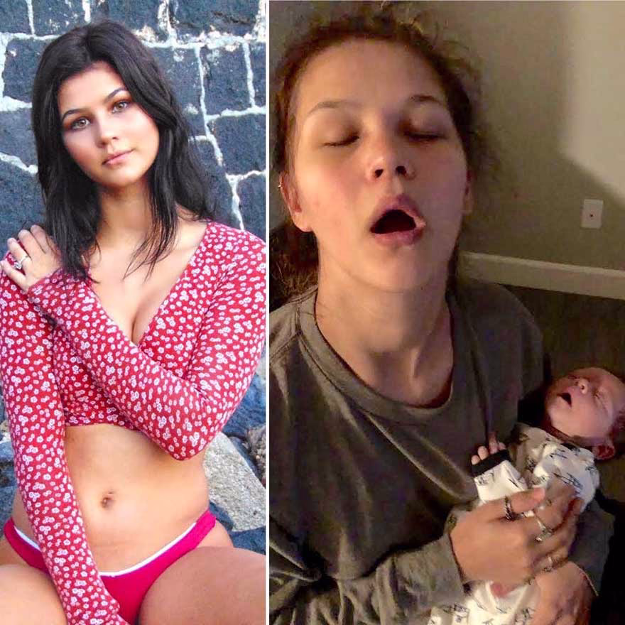 Cocuktan Oncesini Ve Sonrasini Gosteren Fotograflar 16