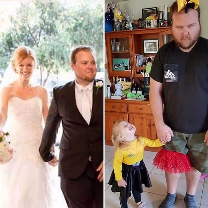 Cocuktan Oncesini Ve Sonrasini Gosteren Fotograflar 19