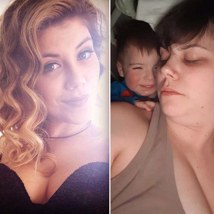 Cocuktan Oncesini Ve Sonrasini Gosteren Fotograflar 26