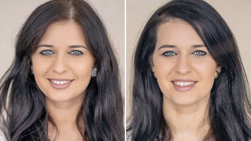 Doğumdan Önce ve Sonra Kadınların Portre Fotoğrafları