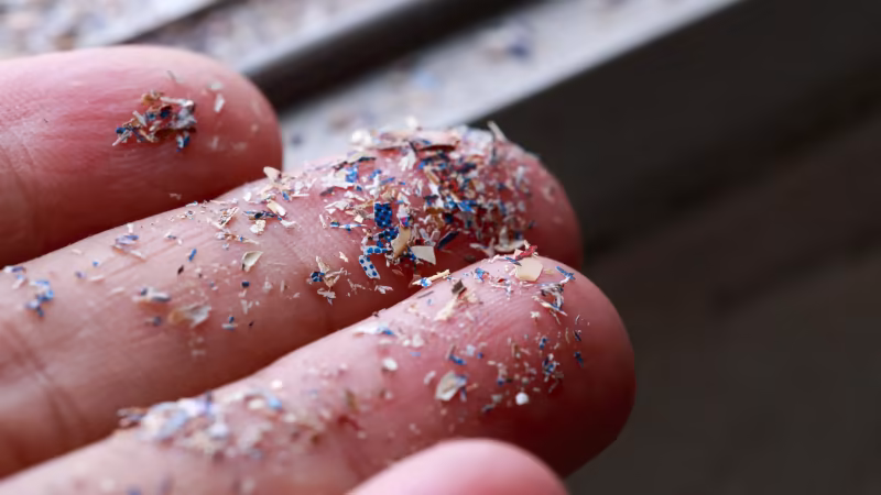 Prostat Kanseri Tümörlerinin %90'ında Mikroplastik Bulundu