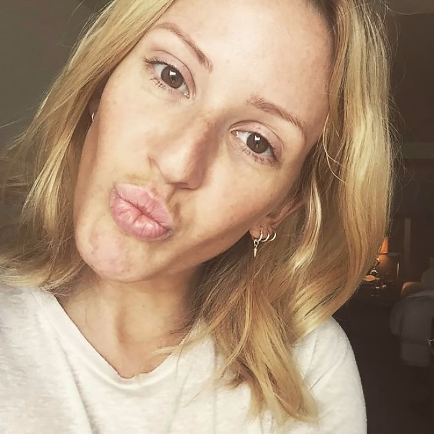 Ellie Goulding makyajsız hali
