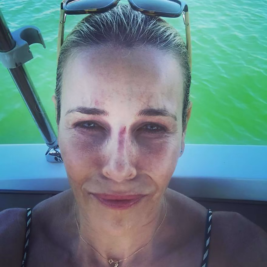 Chelsea Handler makyajsız hali
