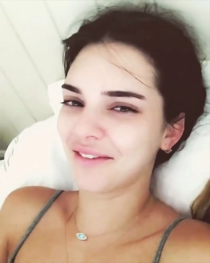 Kendall Jenner makyajsız hali